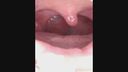 Close-up of the mouth and bad teeth gal! Are you removing the nerves in your front teeth? The throat dick video is also an ant!