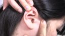 【Ear hole observation】There is too much earwax and the ear hole is blocked!