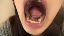 Kotomi Shinomisaki's teeth and mouth selfie