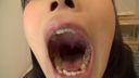 Kotomi Shinomisaki's teeth and mouth selfie