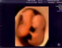 【人体の神秘】妊娠11ヶ月の18歳 B乳を垂れ流しながら痙攣　追い種付け中出し個撮ハメ撮り動画。※在庫本数残り僅かの販売。