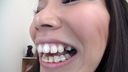 安里泉水ちゃんの歯・口内自撮り 物凄い矯正歯