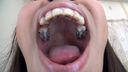 Izumi Asato의 치아와 입 셀카 놀라운 치아 교정