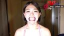 65mm long-tongue sister Nao Hamasaki's silver teeth refilled with white!? Wisdom tooth oral appreciation