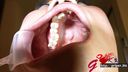 65mm 긴 혀 여동생 하마사키 나오의 은색 이빨이 하얗게 채워진다!? 사랑니 구강 감상