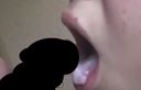 [Oral ejaculation] Gal's removal