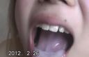 [Oral ejaculation] Gal's removal