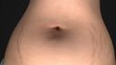 Navel fiddling with stretch marks