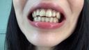 Nishiguchi Arare-chan's subjective teeth and mouth selfie