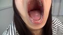 아다치 메이의 치아와 입 셀카