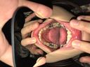 主觀性！　鑲嵌獻給戀牙癖狂熱的女孩觀察北村麗奈的牙齒！