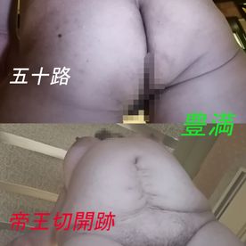 【個人撮影 初撮り】垂れ爆乳豊満熟女50歳 腹の切開跡とビラビラがエログロ！【デブ専向け】 FC2-PPV-4518201