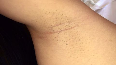 【競泳水着の脇フェチ個撮】ゆうちゃんの脇の下を徹底観察弄り撮り!!