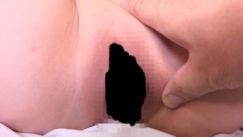 「美人AGA専門女医」は患者のセクハラを受け入れる変態女医だった03「変態パンティ疑惑医師に直撃取材！真偽不明映像」