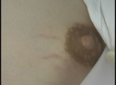 可愛い入院患者ちゃんの可愛いびーちくをちらちら**込んでみたい　07