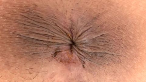 【顔出し・個人撮影】素人*の全裸オマ○コ接写観察動画★はるか25歳