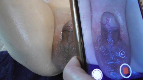 ブラジリアンワックスVIO脱毛施術動画Vol.8【研修モデルに施術練習するメンズエステ店の裏側】