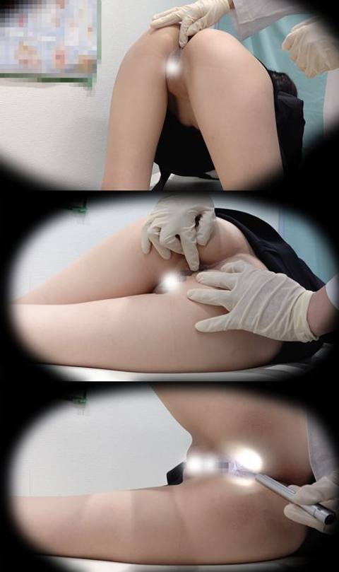 [Anal surgery] Relentless anal medical treatment/patient with expression of agony/****** a system to