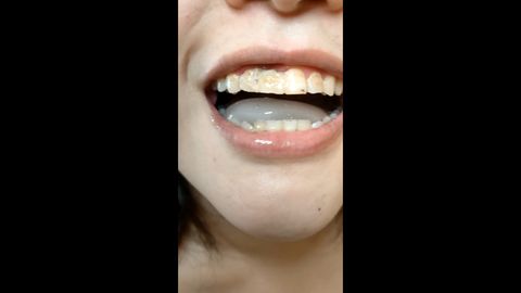 丸呑み!!  淫乱吸口痴女軍団にがっつりホールドされ、1週間溜めた精*を極上のバキュームフェラで全て吸い尽くされるM男【その29】