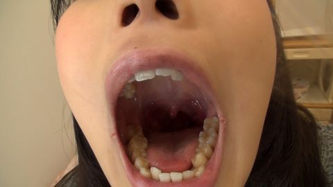 篠岬ことみちゃんの歯・口内自撮り