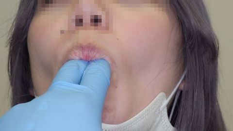 【触診、口腔のダブル羞恥】Gカップお*さんにセクハラ検査。①